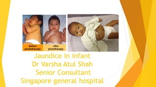 Jaundice in infant
Dr Varsha Atul Shah
Senior Consultant
Singapore general hospital
 