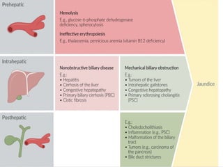 Jaundice Management Racgp Comprehensive Overview of Jaundice: Causes, Diagnosis, and Management ...