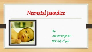 Neonatal jaundice
By,
ABHAY RAJPOOT
MSC (N) 2nd year
 
