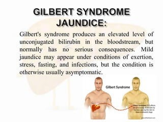  Gilbert's syndrome produces an elevated level of
unconjugated bilirubin in the bloodstream, but
normally has no serious consequences. Mild
jaundice may appear under conditions of exertion,
stress, fasting, and infections, but the condition is
otherwise usually asymptomatic.
 