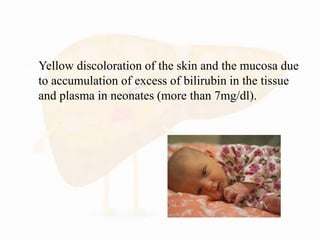  Yellow discoloration of the skin and the mucosa due
to accumulation of excess of bilirubin in the tissue
and plasma in neonates (more than 7mg/dl).
 