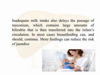  Inadequate milk intake also delays the passage of
meconium, which contains large amounts of
bilirubin that is then transferred into the infant’s
circulation. In most cases breastfeeding can, and
should, continue. More feedings can reduce the risk
of jaundice
 