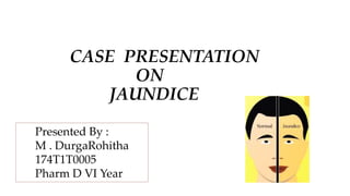 CASE PRESENTATION
ON
JAUNDICE
Presented By :
M . DurgaRohitha
174T1T0005
Pharm D VI Year
 
