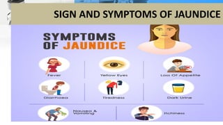SIGN AND SYMPTOMS OF JAUNDICE
 
