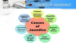 CAUSES OF JAUNDINCE
 