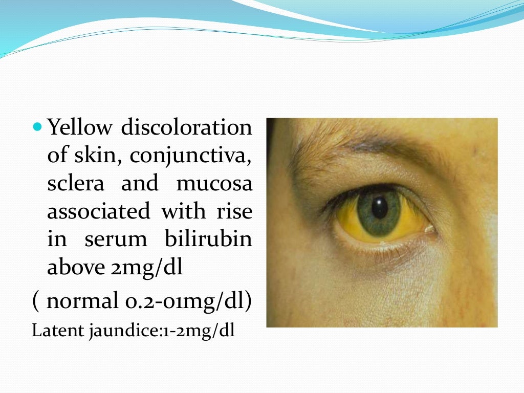 Jaundice IN PREGNANCY