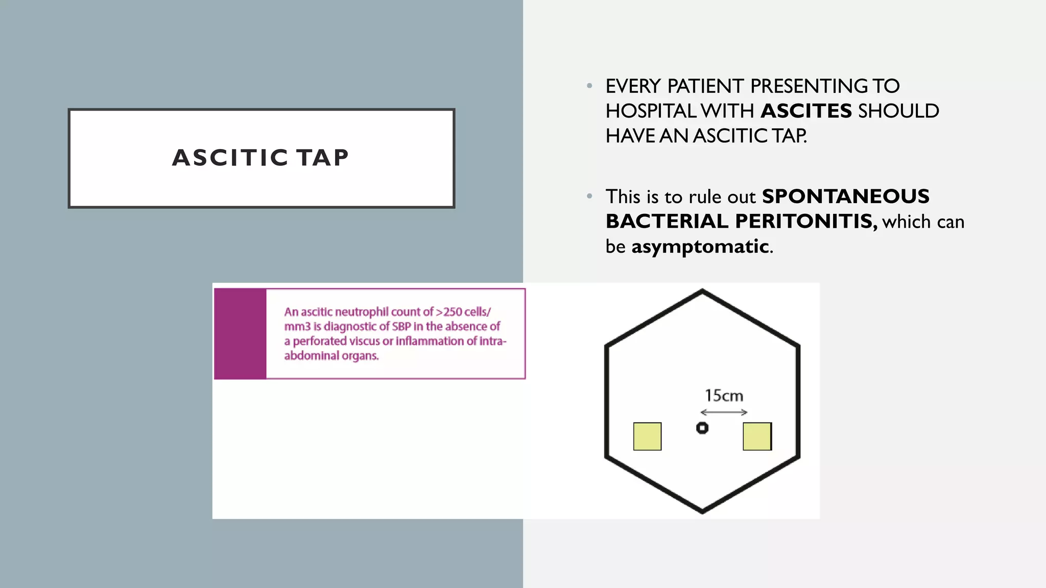 ASCITIC TAP
• EVERY PATIENT PRESENTING TO
HOSPITAL WITH ASCITES SHOULD
HAVE AN ASCITIC TAP.
• This is to rule out SPONTANEOUS
BACTERIAL PERITONITIS, which can
be asymptomatic.
 