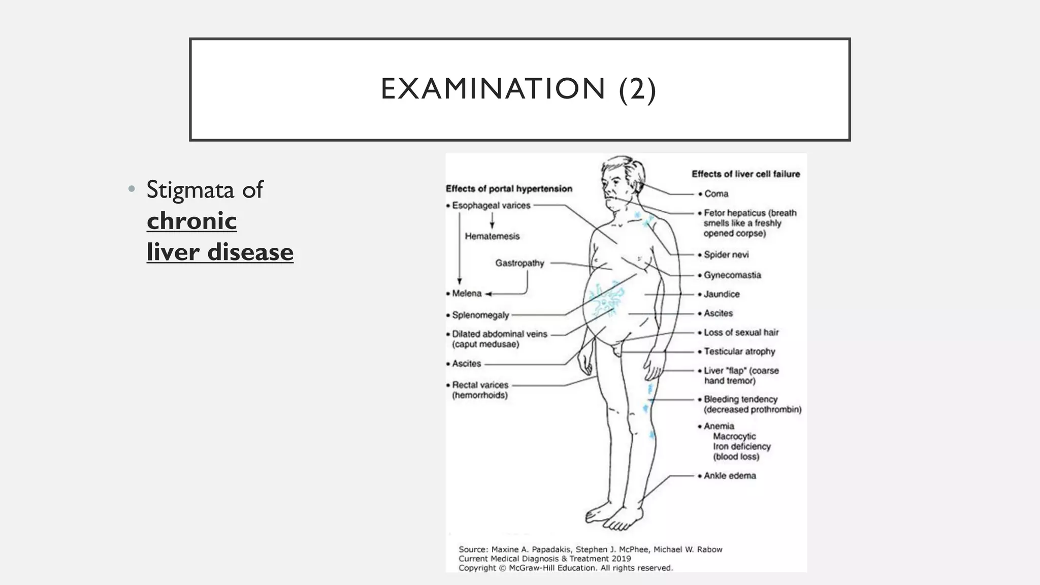 EXAMINATION (2)
• Stigmata of
chronic
liver disease
 