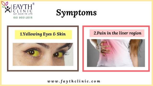 Yellow Fever Vaccination In Mumbai Hepatitis B Treatment Jaundice