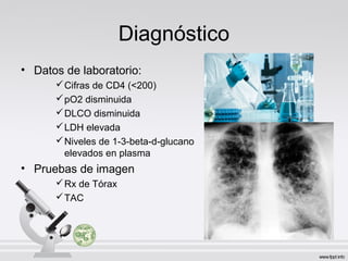 Diagnóstico
• Datos de laboratorio:
Cifras de CD4 (<200)
pO2 disminuida
DLCO disminuida
LDH elevada
Niveles de 1-3-beta-d-glucano
elevados en plasma
• Pruebas de imagen
Rx de Tórax
TAC
 