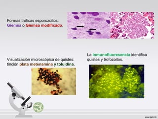 Visualización microscópica de quistes:
tinción plata metenamina y toluidina.
Formas tróficas esporozoitos:
Giemsa o Giemsa modificado.
La inmunofluoresencia identifica
quistes y trofozoitos.
 