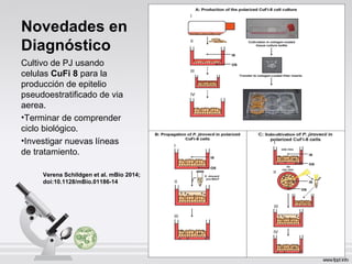 Novedades en
Diagnóstico
Cultivo de PJ usando
celulas CuFi 8 para la
producción de epitelio
pseudoestratificado de via
aerea.
•Terminar de comprender
ciclo biológico.
•Investigar nuevas líneas
de tratamiento.
Verena Schildgen et al. mBio 2014;
doi:10.1128/mBio.01186-14
 