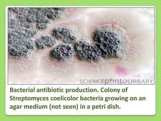Bacterial antibiotic production. Colony of
Streptomyces coelicolor bacteria growing on an
agar medium (not seen) in a petri dish.

 