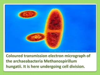 Coloured transmission electron micrograph of
the archaeabacteria Methanospirillum
hungatii. It is here undergoing cell division.

 