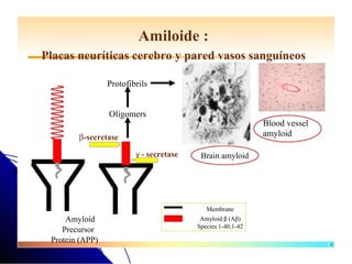 Amiloide :
Placas neuríticas cerebro y pared vasos sanguíneos

  NH2            Protofibrils


                 Oligomers
                                                             Blood vessel
        β-secretase                                          amyloid

                         γ - secretase    Brain amyloid




                                            Membrane
     Amyloid                              Amyloid β (Aβ)
                                         Species 1-40,1-42
    Precursor
 Protein (APP)                                                              66
 