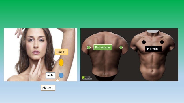 Arteria axilar biomagnetismo_3