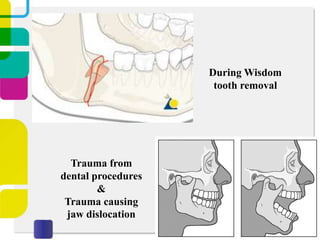 During Wisdom
tooth removal

Trauma from
dental procedures
&
Trauma causing
jaw dislocation

 