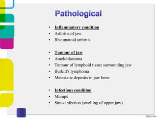 • Inflammatory condition
• Arthritis of jaw
• Rheumatoid arthritis
•
•
•
•
•

Tumour of jaw
Ameloblastoma
Tumour of lymphoid tissue surrounding jaw
Burkitt's lymphoma
Metastatic deposits in jaw bone

• Infectious condition
• Mumps
• Sinus infection (swelling of upper jaw)

 