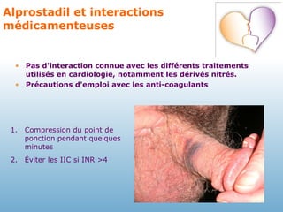 Alprostadil et interactions médicamenteuses Pas d'interaction connue avec les différents traitements utilisés en cardiologie, notamment les dérivés nitrés. Précautions d'emploi avec les anti-coagulants Compression du point de ponction pendant quelques minutes Éviter les IIC si INR >4 