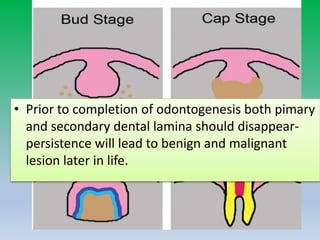 • Prior to completion of odontogenesis both pimary
and secondary dental lamina should disappear-
persistence will lead to benign and malignant
lesion later in life.
 