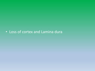 • Loss of cortex and Lamina dura
 