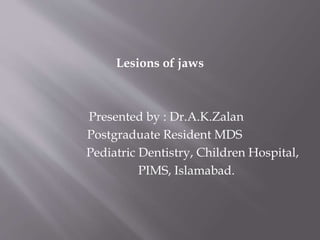Lesions of jaws
Presented by : Dr.A.K.Zalan
Postgraduate Resident MDS
Pediatric Dentistry, Children Hospital,
PIMS, Islamabad.
 