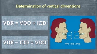 Determination of vertical dimensions
 