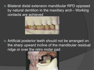Jaw relation in rpd | PPTX