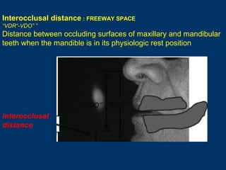 Jaw relation | PPT
