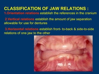 CLASSIFICATION OF JAW RELATIONS :
1.Orientation relations establish the references in the cranium
2.Vertical relations establish the amount of jaw separation
allowable for use for dentures
3.Horizontal relations establish front- to-back & side-to-side
relations of one jaw to the other

 