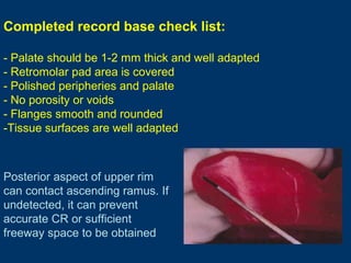 Completed record base check list:
- Palate should be 1-2 mm thick and well adapted
- Retromolar pad area is covered
- Poli...
