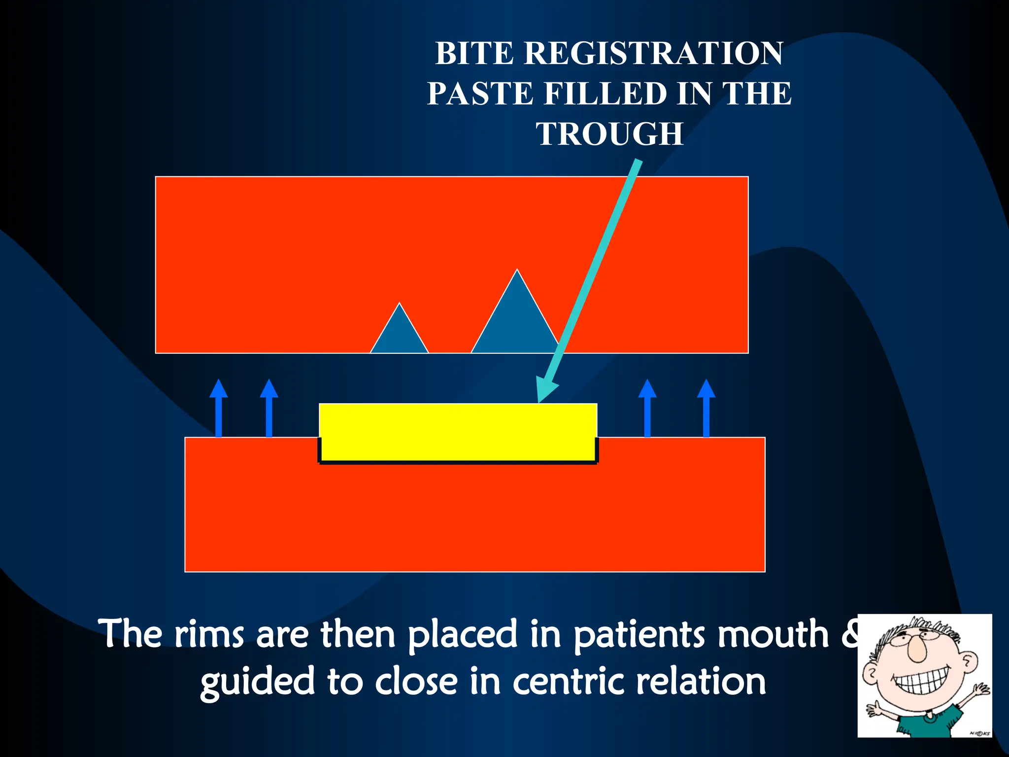 BITE REGISTRATION
PASTE FILLED IN THE
TROUGH
The rims are then placed in patients mouth &
guided to close in centric relation
 