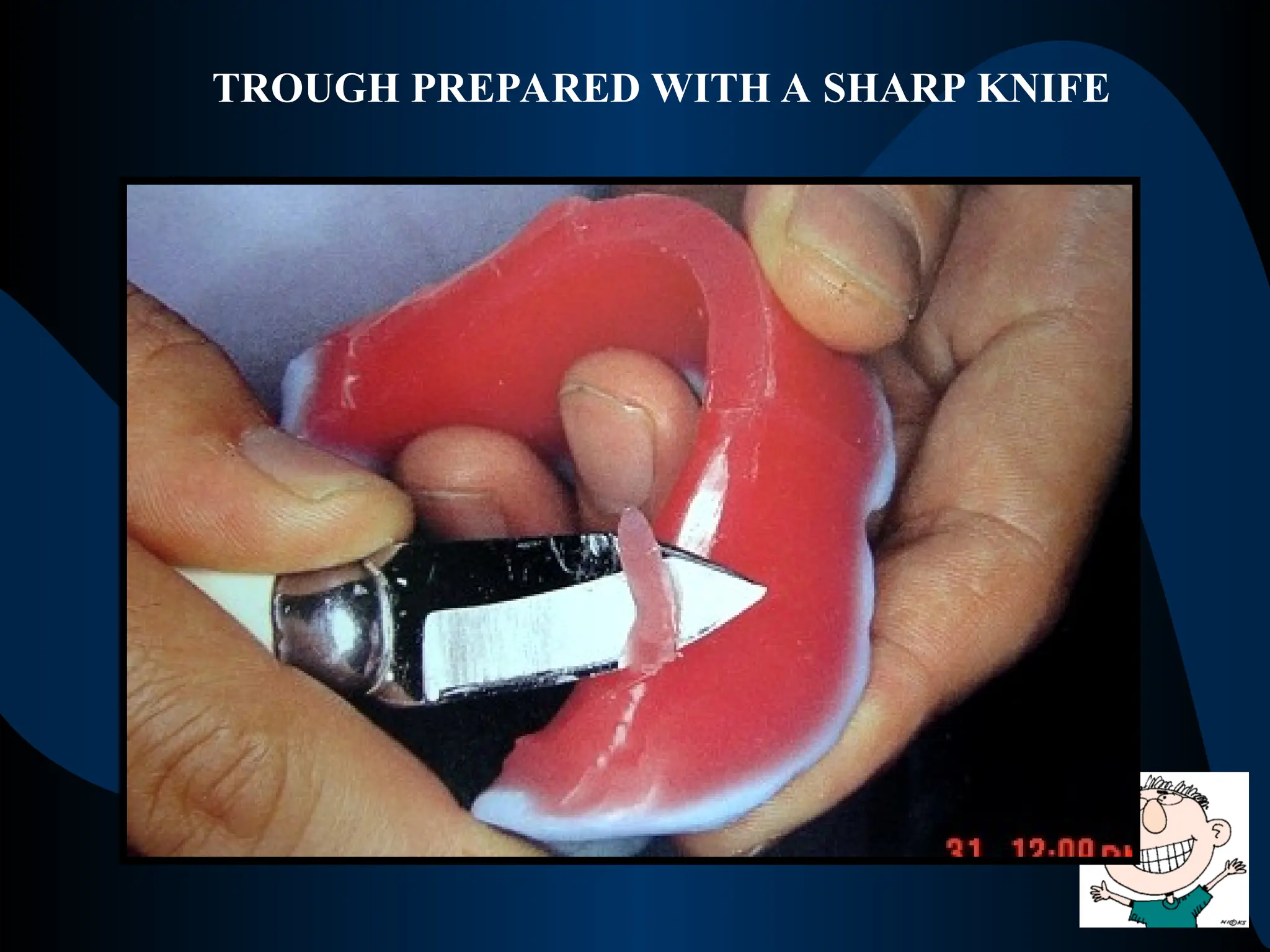 TROUGH PREPARED WITH A SHARP KNIFE
 