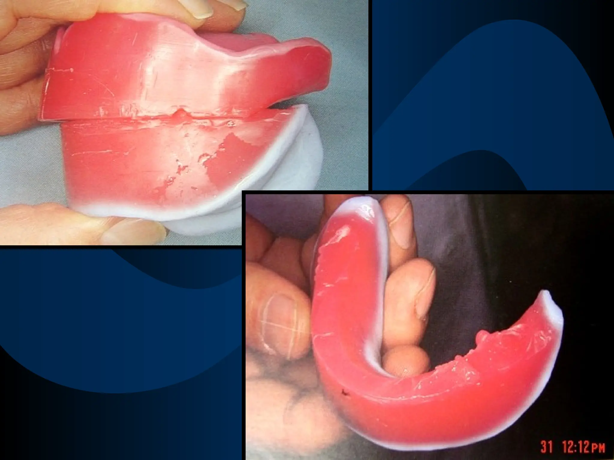 JAW RELATIONS                                     .ppt