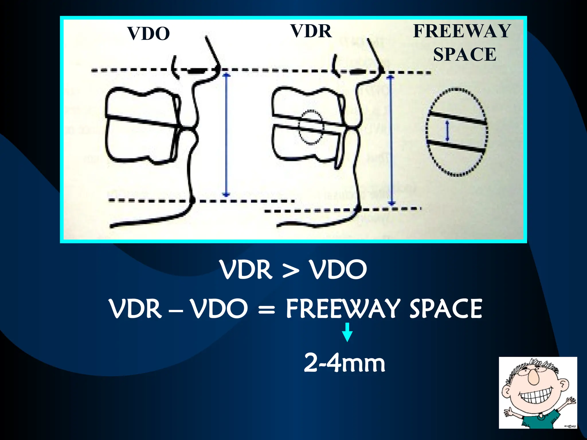 VDR > VDO
VDR – VDO = FREEWAY SPACE
VDO VDR FREEWAY
SPACE
2-4mm
 