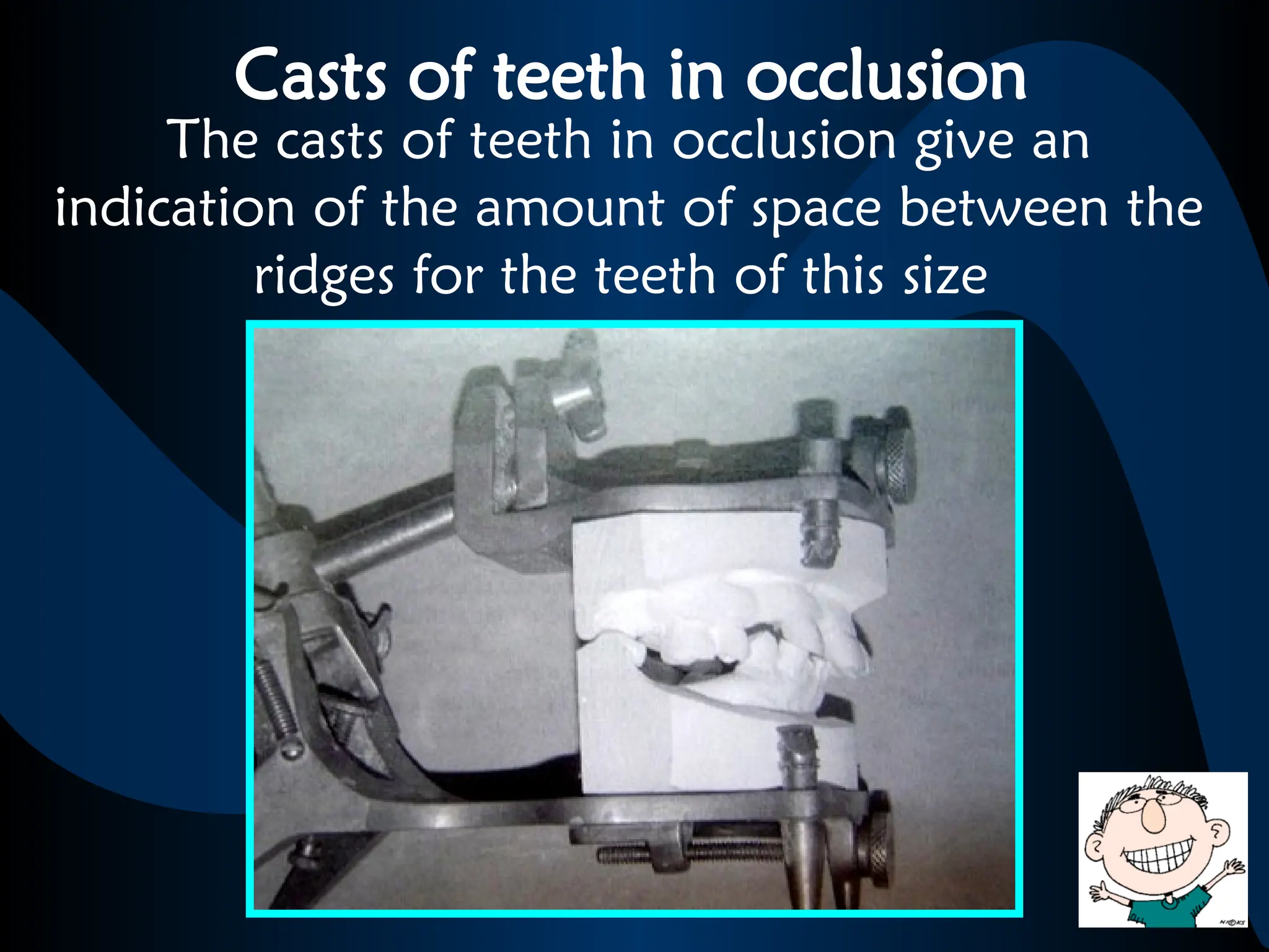 Casts of teeth in occlusion
The casts of teeth in occlusion give an
indication of the amount of space between the
ridges for the teeth of this size
 