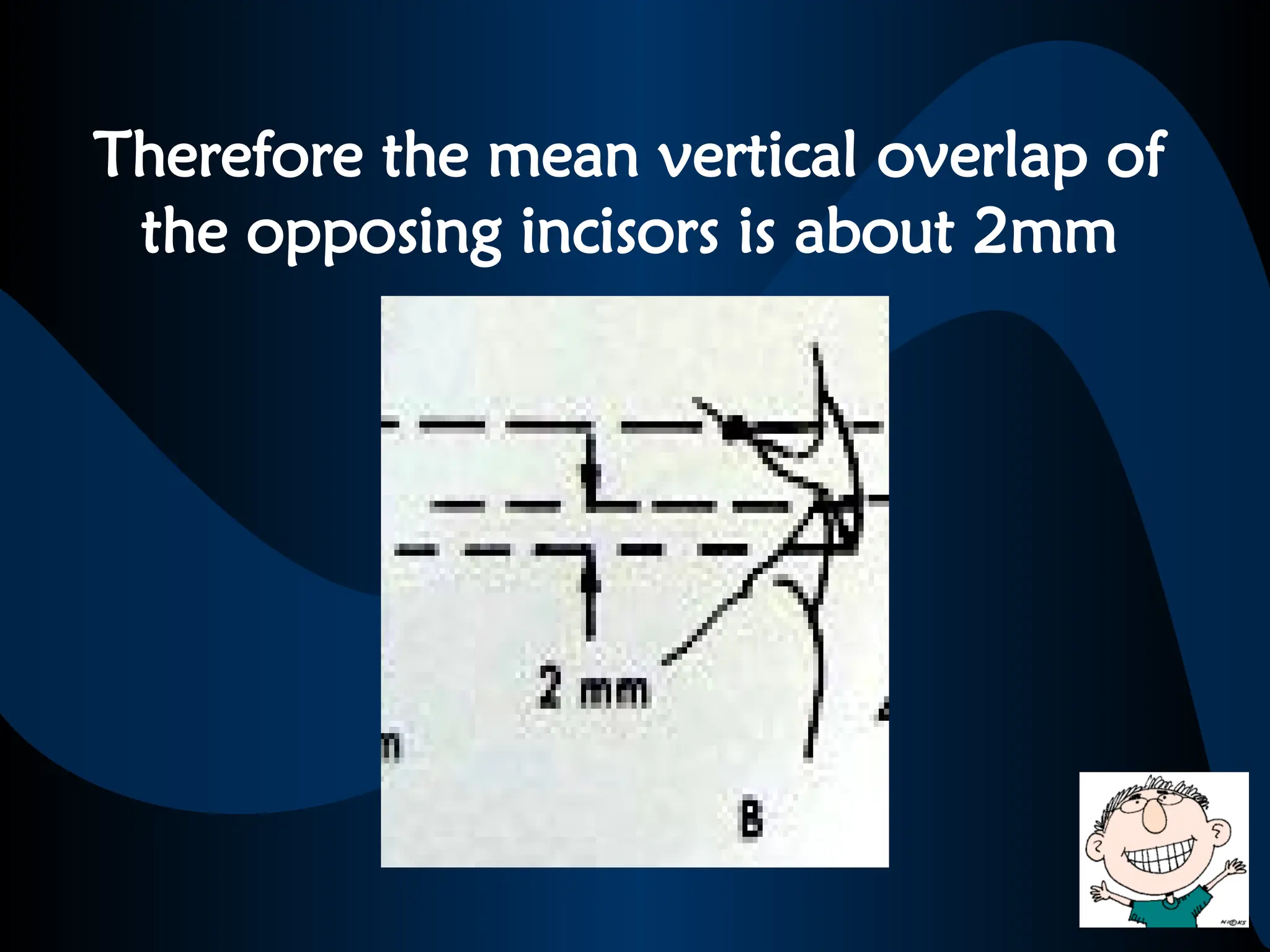 Therefore the mean vertical overlap of
the opposing incisors is about 2mm
 