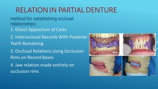 Partial Registration Rim jaw relation in complete and partial denture | PPTX