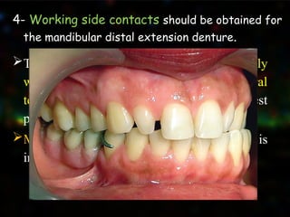 jaw relations of removable partial denture .pptx