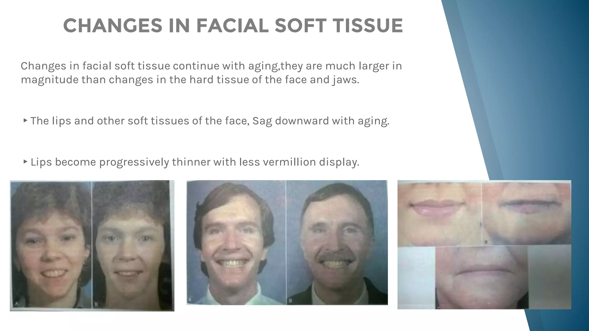 Jaw rotation(ortho) | PPTX