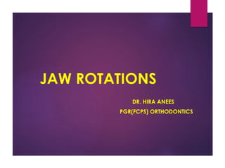 Jaw rotations