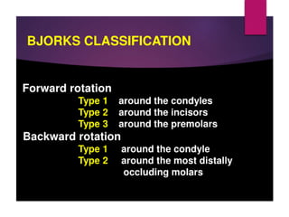 Jaw rotations