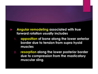 Jaw rotations