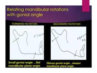 Jaw rotations