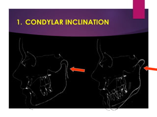 Jaw rotations