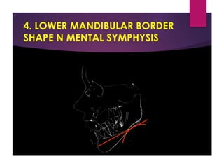Jaw rotations