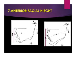 Jaw rotations
