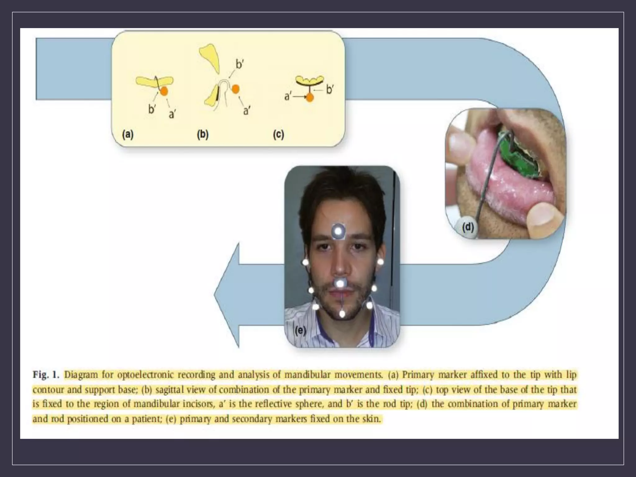 Registration of Mandibular movements .pdf