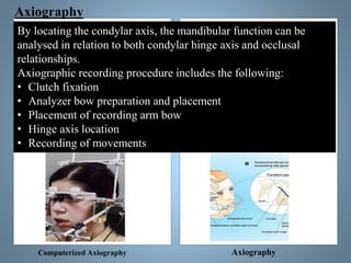 Registration of Mandibular movements .pdf