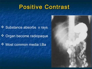 Positive ContrastPositive Contrast
 Substance absorbs x rays
 Organ become radiopaque
 Most common media I,Ba
 